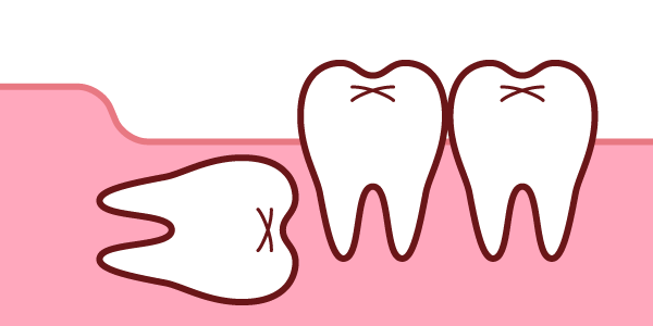 斜めに生えている