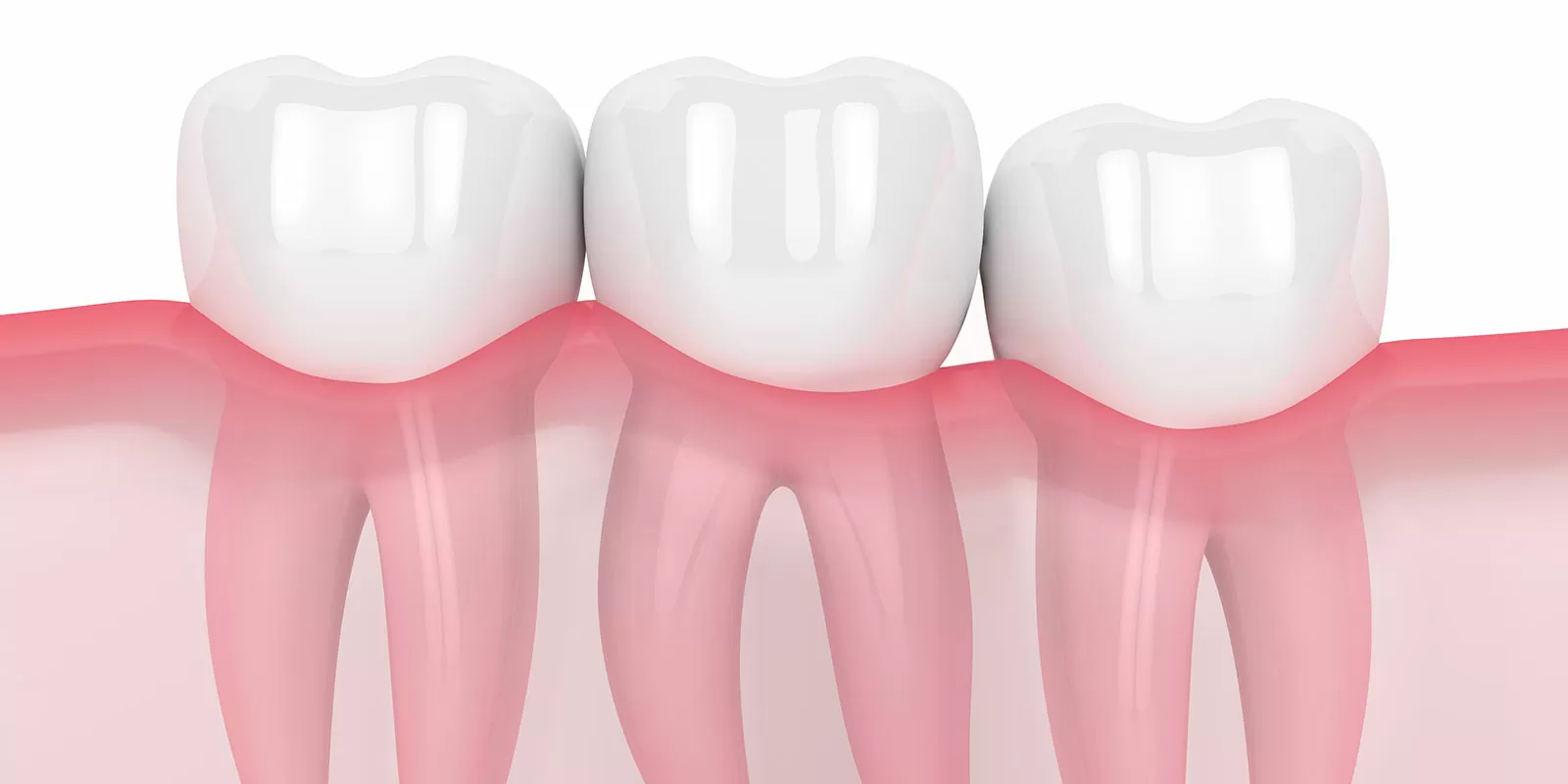 逆に「抜かなくてもいい親知らず」とは？
