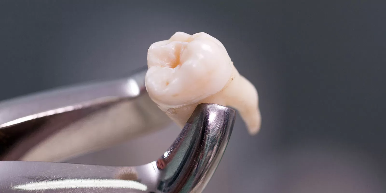 放置するとどうなる？共通する二次被害のリスク